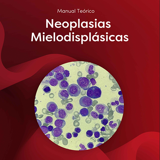 Neoplasias Mielodisplásicas
