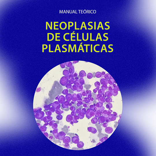 Neoplasias de Células Plasmáticas